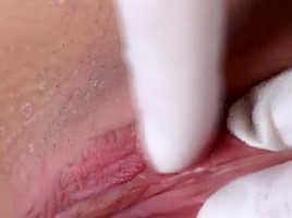 Alice Gyno Exam ( 3 of 7)