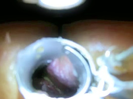 Bizarre fisting, double fisting, toys, anal birth, 1