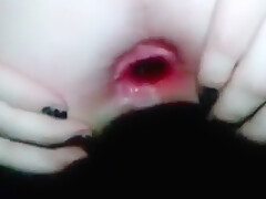Huge Butt Hole Enormous Dildo In Ass